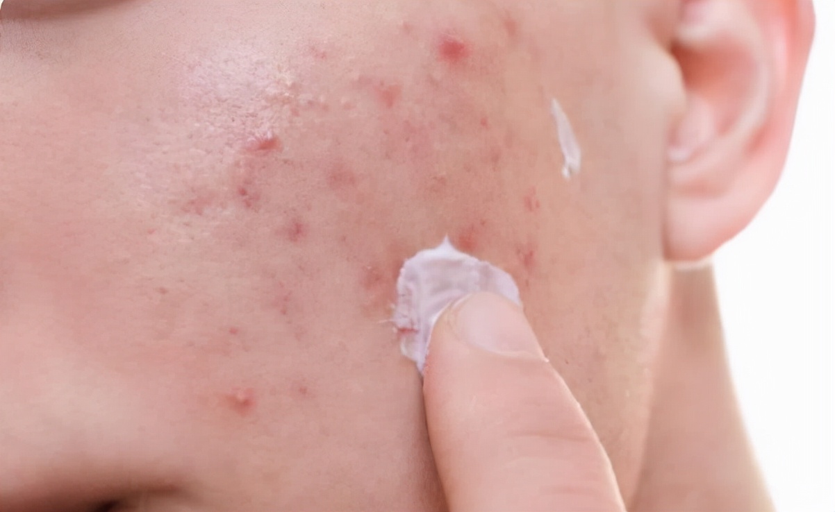 面部皮膚油膩？學(xué)會(huì)這3個(gè)洗臉小技巧，讓你遠(yuǎn)離“毛孔粗大”煩惱